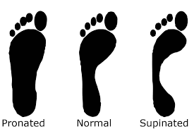 Foot arch types: pronated, normal, supinated for comfortable footwear selection